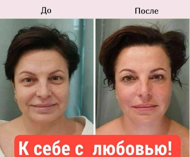 САМОМАССАЖ ЛИЦА