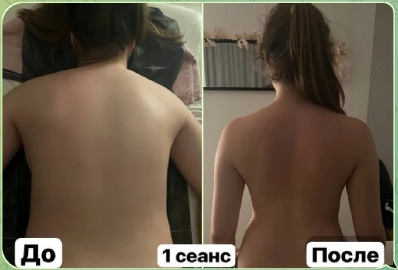 Коррекция фигуры и спины косметология и массаж 3