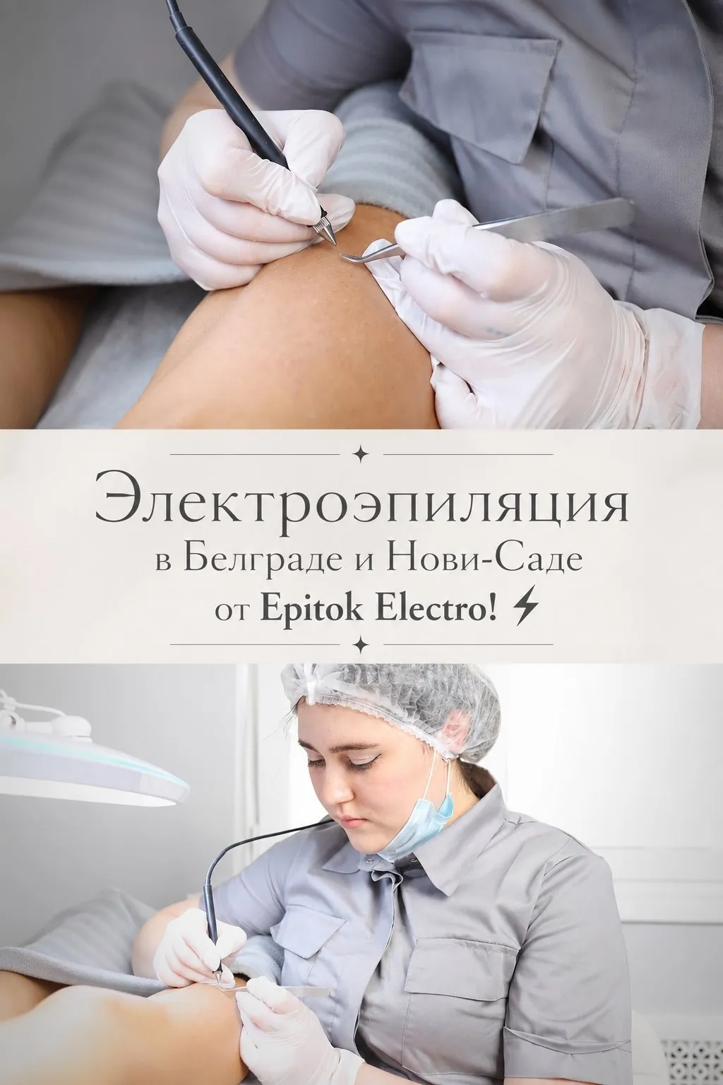 **Электроэпиляция в Белграде и Нови-Саде от Epitok Electro! ⚡** 1